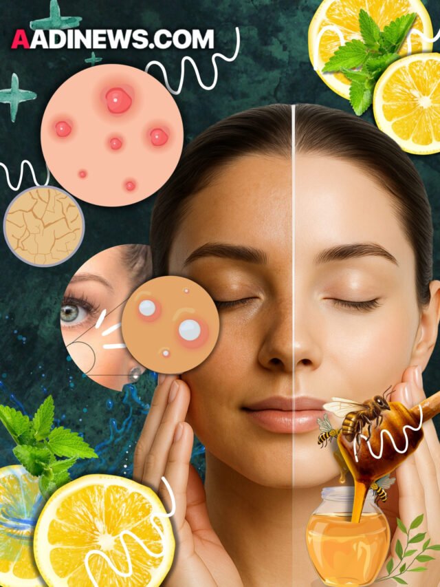 Natural Face Packs for Glowing Skin: Pimples, Tan & Dark Circles, Dry Skin, Acne Pimples Solution